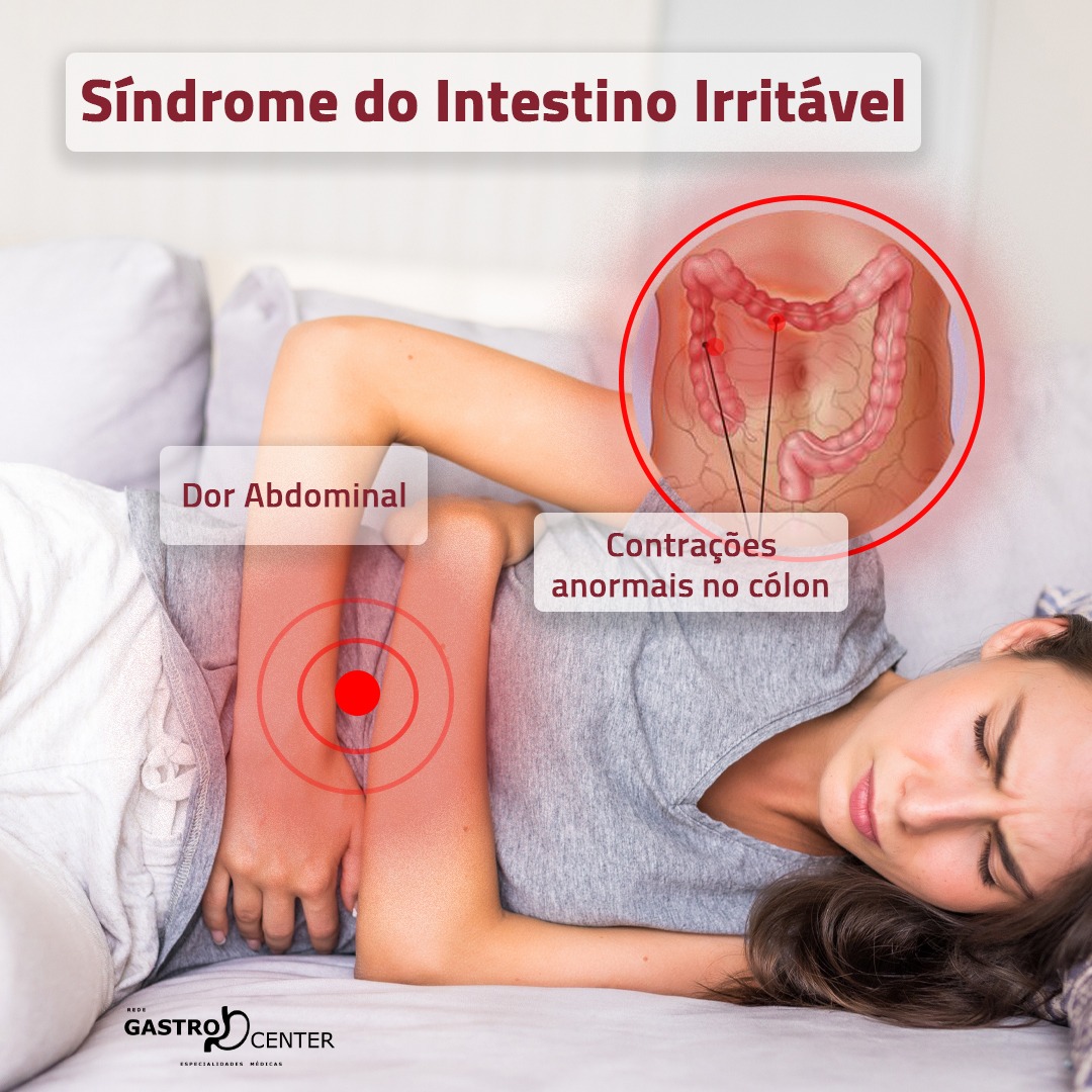 Síndrome do Intestino Irritável.