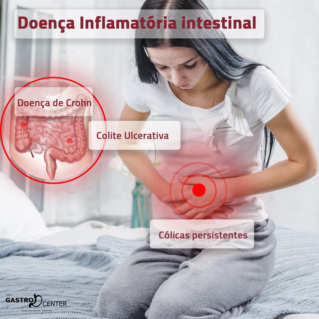 Doença Inflamatória intestinal